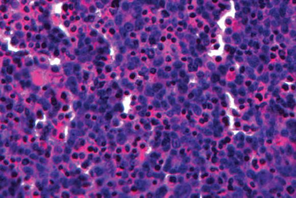 Liver Tissue